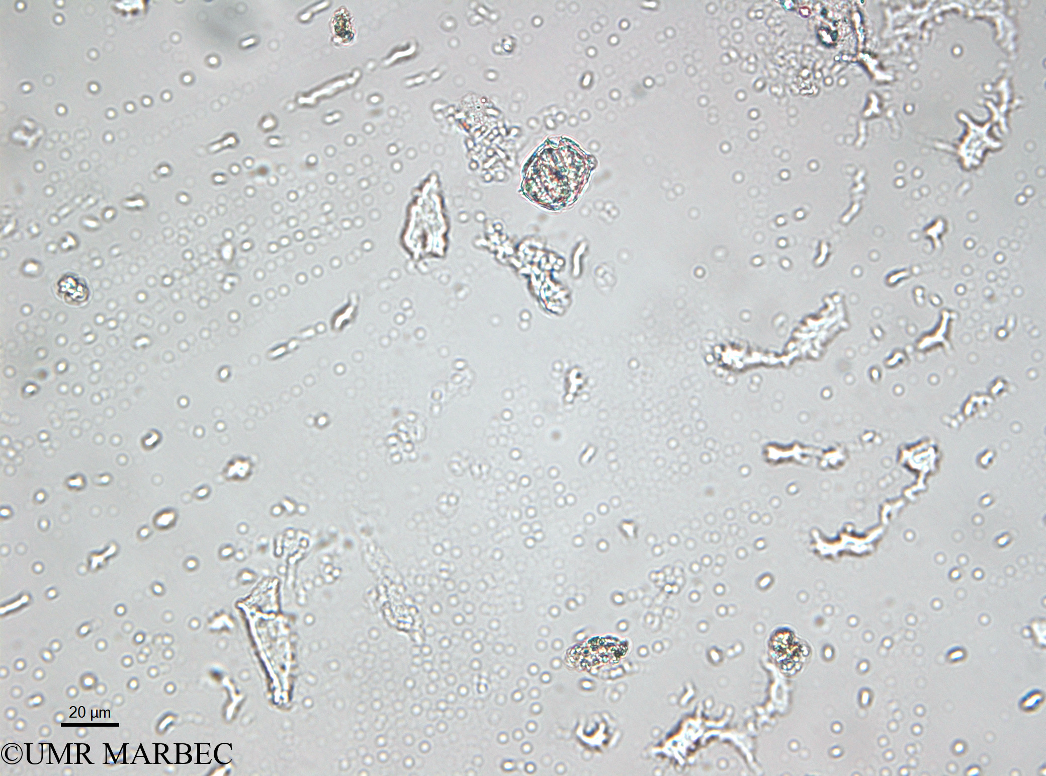 phyto/Bizerte/bizerte_lagoon/RISCO April 2014/Gonyaulax spinifera (- 2140730-2).tif(copy).jpg